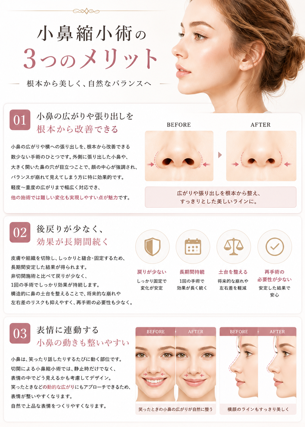 隆鼻術（プロテーゼ）メリット