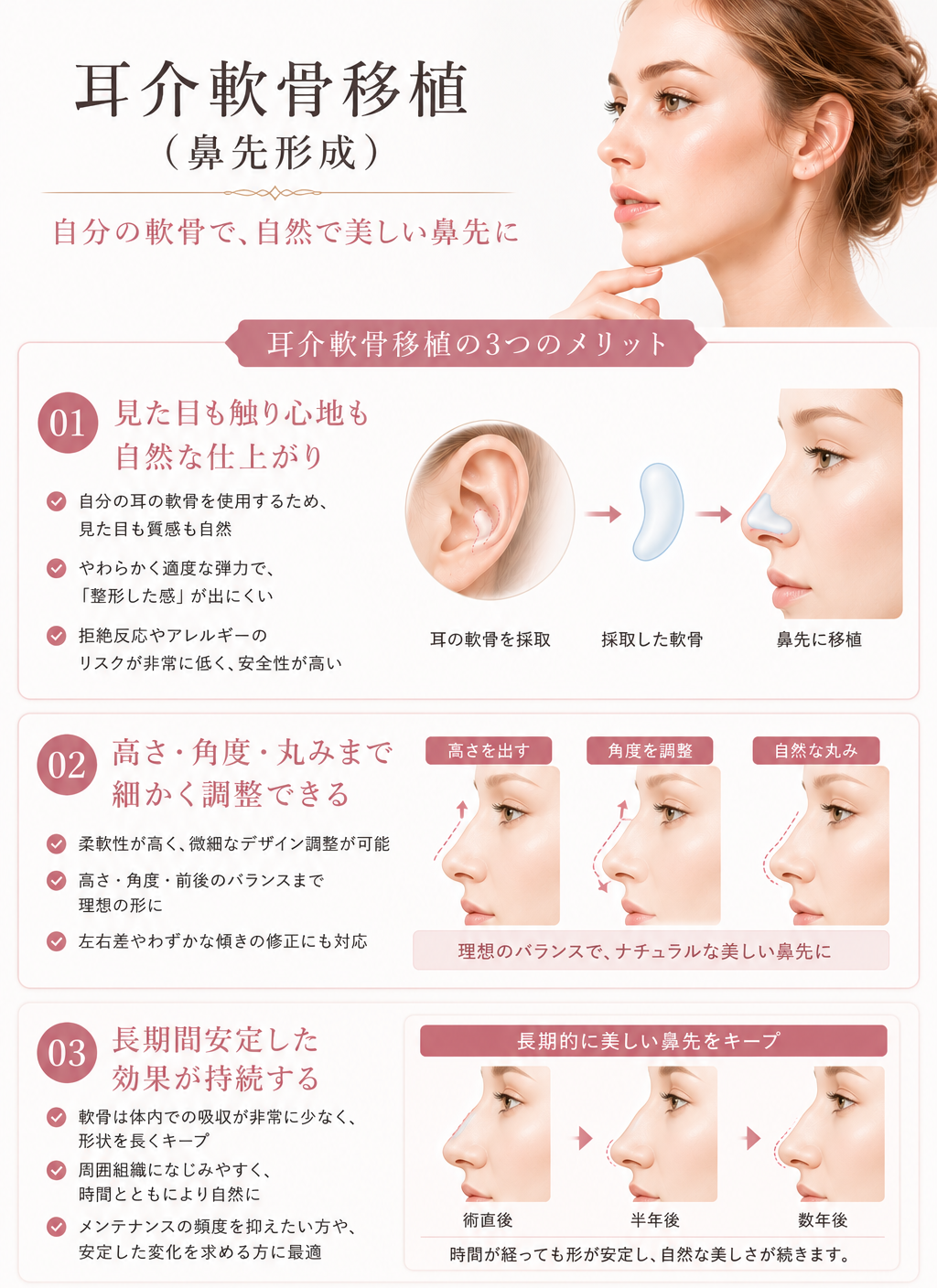 鼻尖形成（耳介軟骨移植）メリット