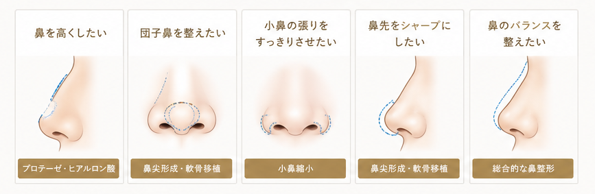 鼻の整形・概要